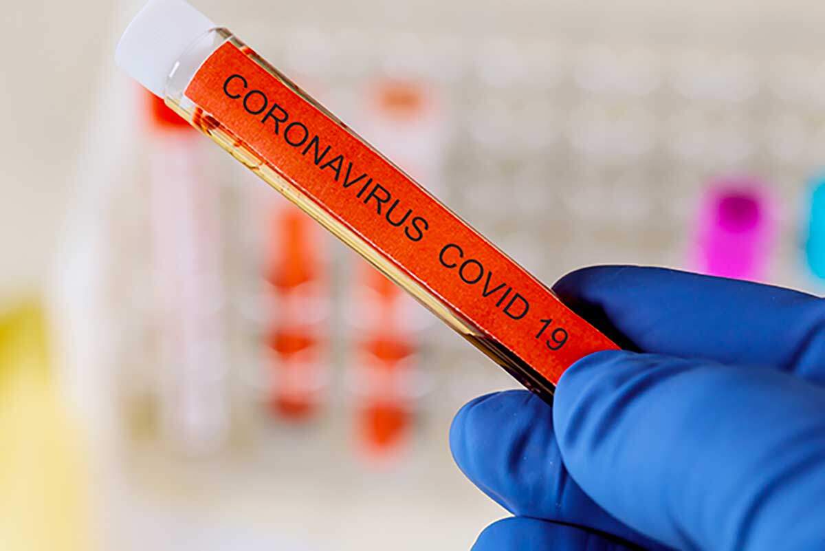 Coronavirus test